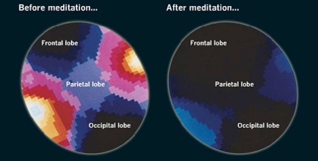 brain on meditation